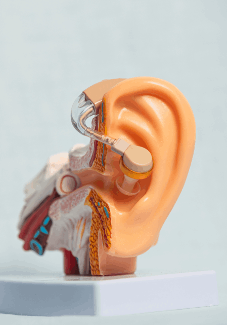 tinnitus